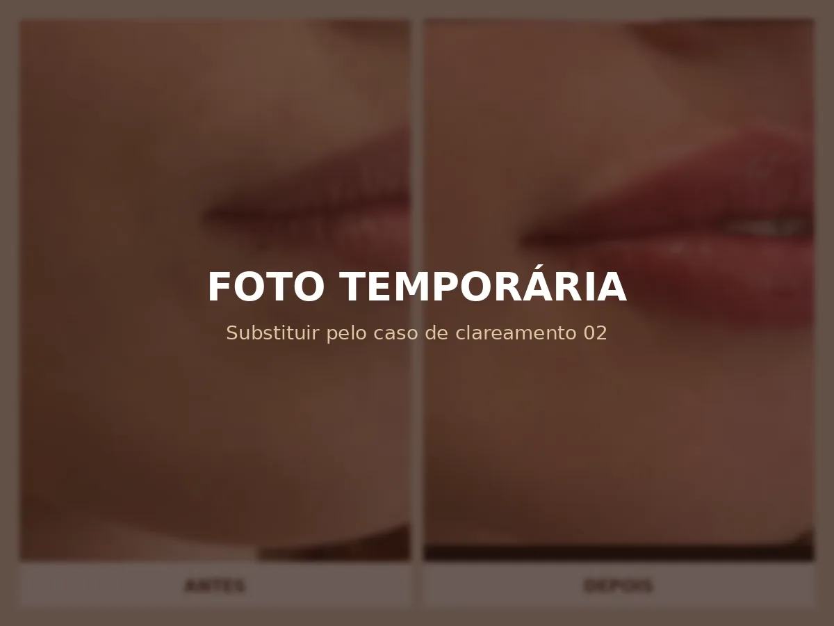 Espaço reservado para antes e depois de clareamento dental 2
