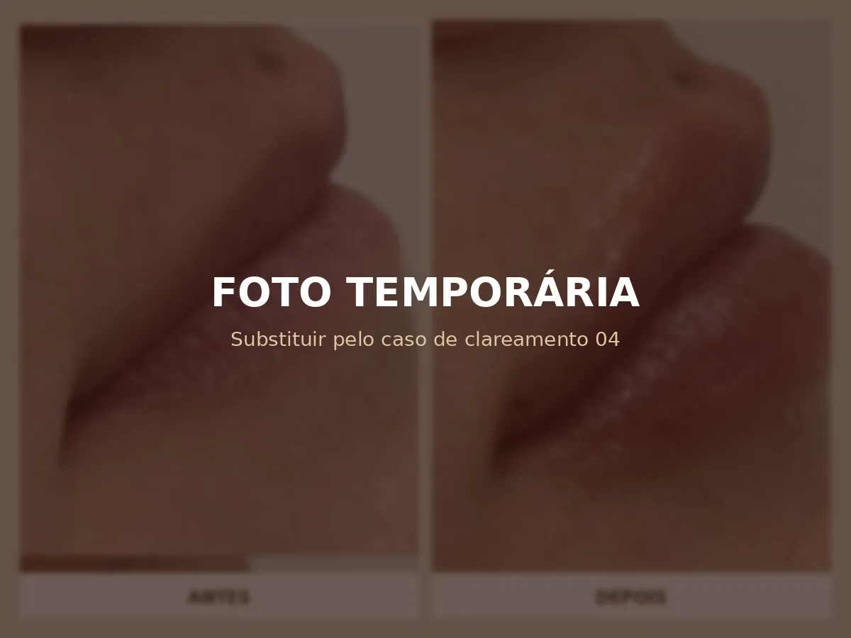 Espaço reservado para antes e depois de clareamento dental 4